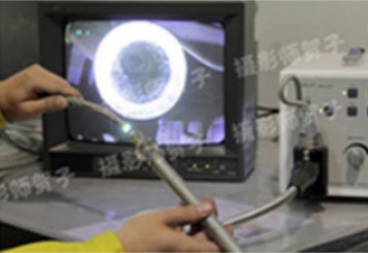 Endoscope